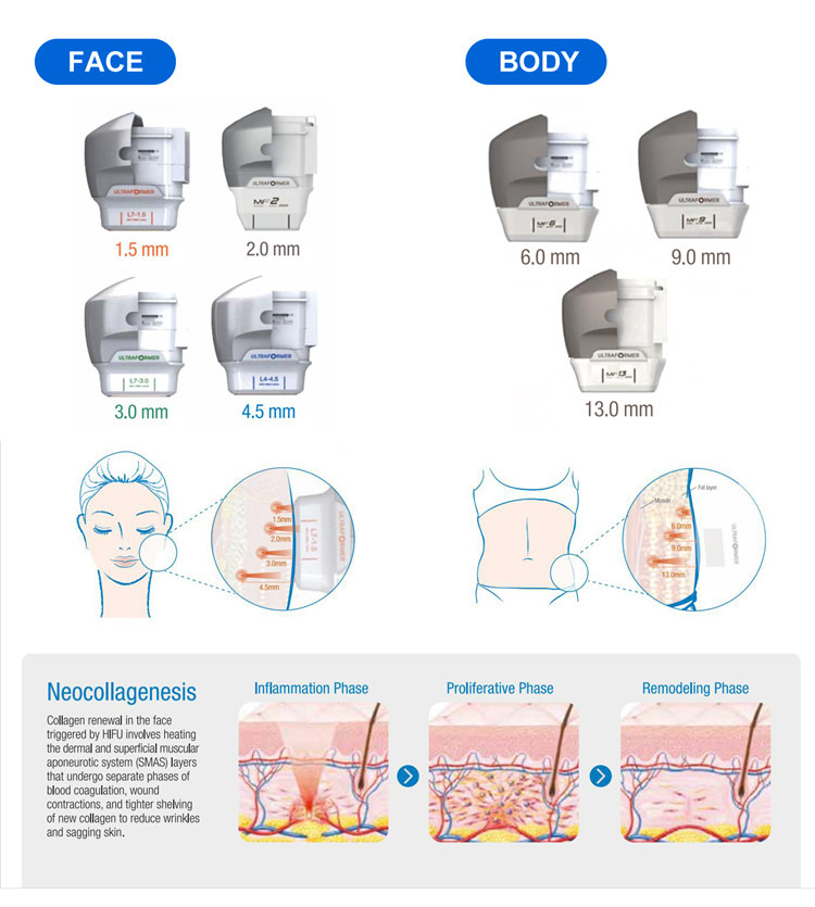 Meaisín slimming comhlacht ardaithe aghaidh 7D HIFU (5)