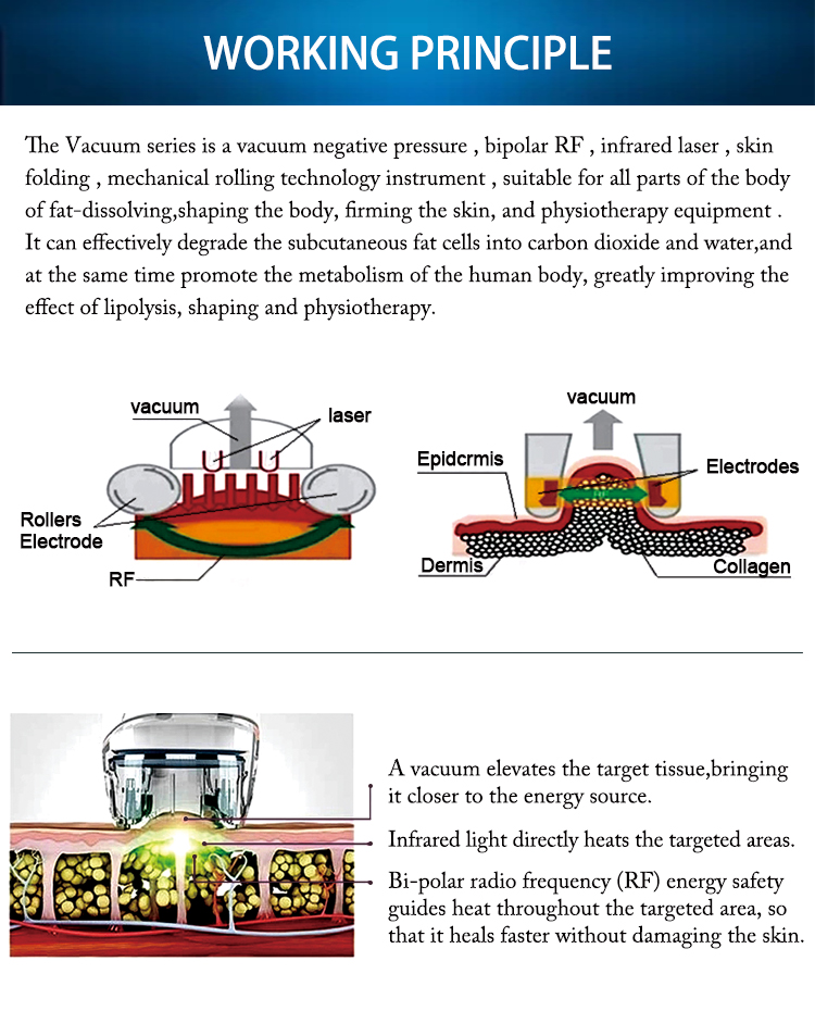 RF vacuum massage vela shaping body contouring machine (1)